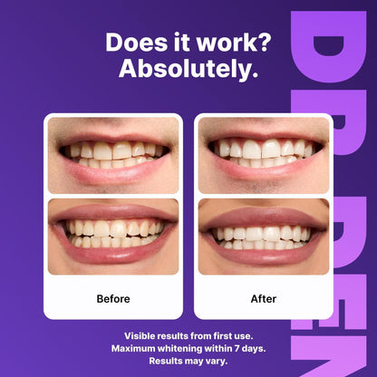 🔥DRDENT Purple Teeth Whitening Strips - 7/21 Whitening Sessions - Safe for Enamel - Non Sensitive Teeth Whitening - Peroxide-Free🍃-LGZ